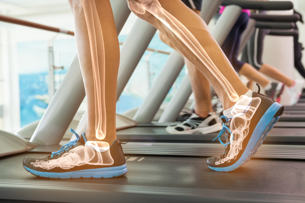 5 Health Benefits From Treadmill Running - Nordictrack Promo Codes